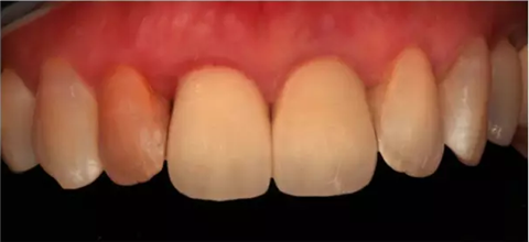 【培訓(xùn)】李京平 • 臨床精準(zhǔn)比色方案 • 8小時(shí)培訓(xùn)班.png 【培訓(xùn)】李京平 • 臨床精準(zhǔn)比色方案 • 8小時(shí)培訓(xùn)班.png