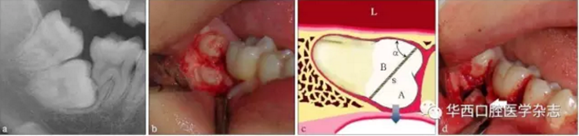 DO32DD`{QFX3RUXC7@}K4BQ.png DO32DD`{QFX3RUXC7@}K4BQ.png