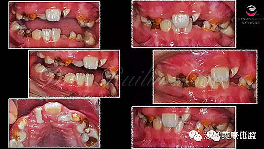 C4ZKOX}[Z0}@%8[)VLFL12Q.png C4ZKOX}[Z0}@%8[)VLFL12Q.png