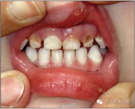 MJ~Q`{L77TP`TP)0LWG5%{Y.png MJ~Q`{L77TP`TP)0LWG5%{Y.png