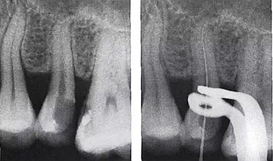 FK2O9E$6TQA~A0}2PG{F{3F.png FK2O9E$6TQA~A0}2PG{F{3F.png