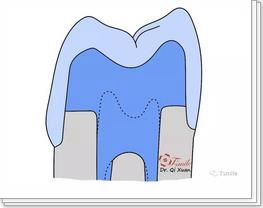 360截圖20170422115035865.jpg 360截圖20170422115035865.jpg