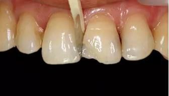 360截圖20170422122614839.jpg 360截圖20170422122614839.jpg