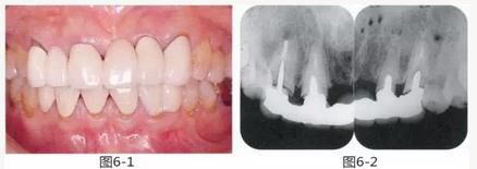 360截圖20170422150040350.jpg 360截圖20170422150040350.jpg