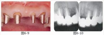 360截圖20170422150108257.jpg 360截圖20170422150108257.jpg