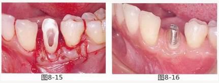 360截圖20170422150225350.jpg 360截圖20170422150225350.jpg