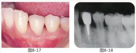 360截圖20170422150232726.jpg 360截圖20170422150232726.jpg