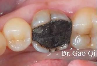 360截圖20170422163727123.jpg 360截圖20170422163727123.jpg