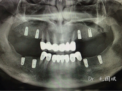 mmexport1493090943165.jpg mmexport1493090943165.jpg