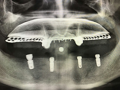 mmexport1493090952079.jpg mmexport1493090952079.jpg