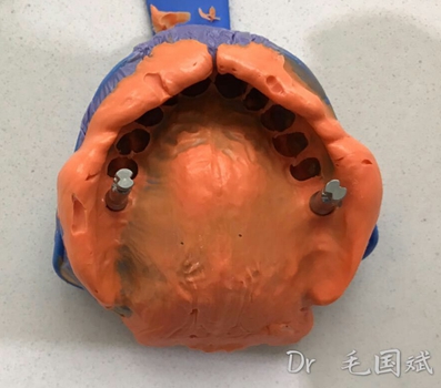 mmexport1493090969886.jpg mmexport1493090969886.jpg