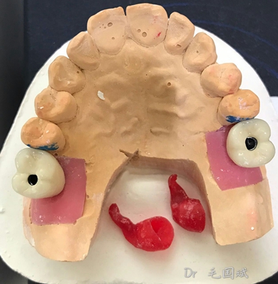 mmexport1493090974802.jpg mmexport1493090974802.jpg