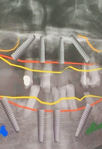 mmexport1493090981101.jpg mmexport1493090981101.jpg