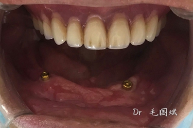 mmexport1493090985721.jpg mmexport1493090985721.jpg