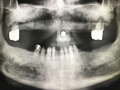 mmexport1493090991830.jpg mmexport1493090991830.jpg