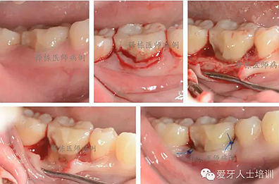 KRAJK0`J9){U)_K0F[`OSUY.png KRAJK0`J9){U)_K0F[`OSUY.png