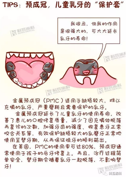 牙縫間的黑線是鄰面齲，還一壞壞倆，巧用它幫你渡過一&ldquo;劫&rdquo;