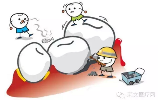 口腔小知識(shí)-教你如何甄別牙齦瘤 口腔小知識(shí)-教你如何甄別牙齦瘤