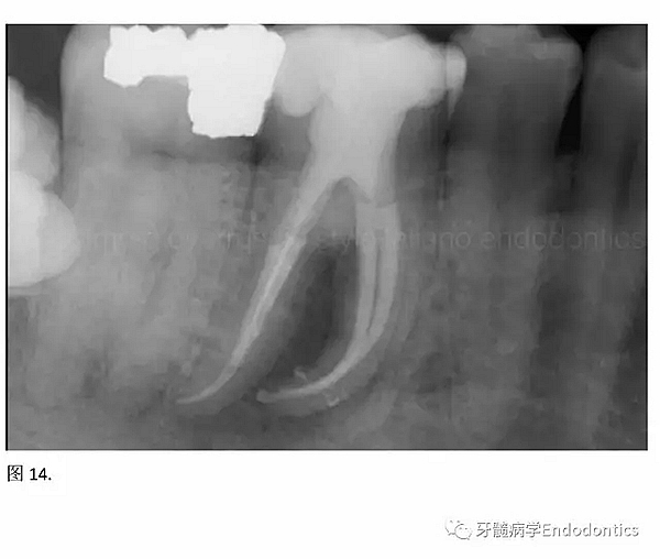 15.webp.jpg 15.webp.jpg