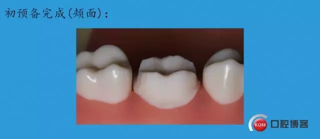 11.webp.jpg 11.webp.jpg