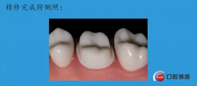 14.webp.jpg 14.webp.jpg