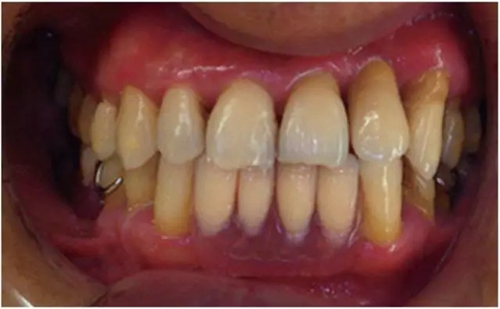 12.webp.jpg 12.webp.jpg