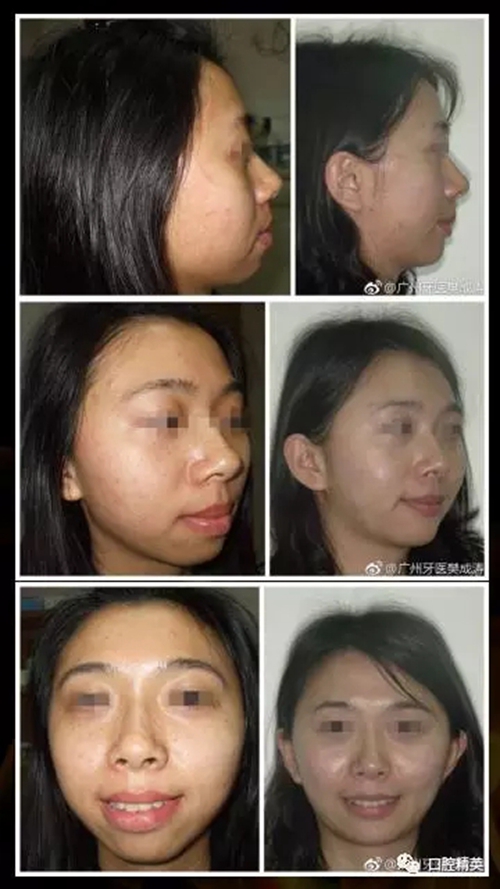 14.webp.jpg 14.webp.jpg