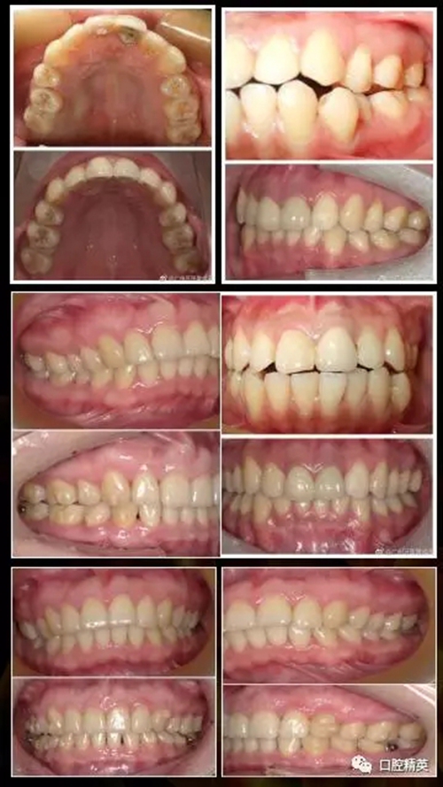 17.webp.jpg 17.webp.jpg