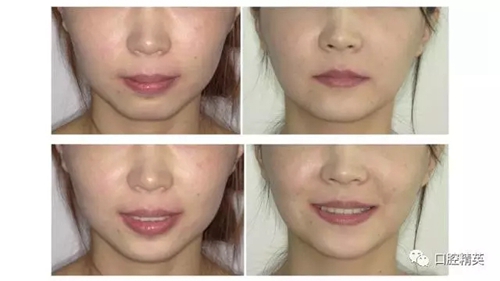 19.webp.jpg 19.webp.jpg