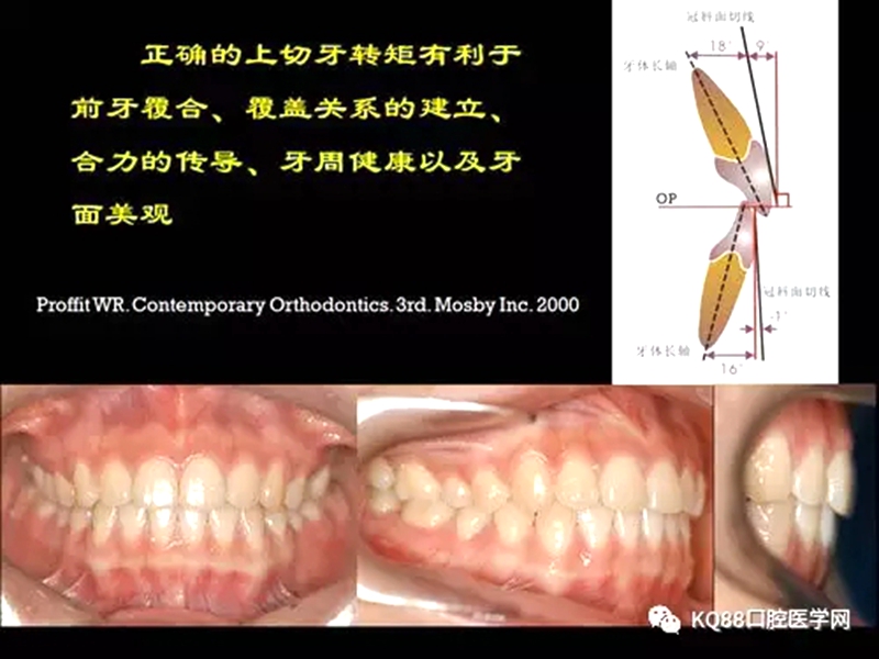 2.webp.jpg 2.webp.jpg