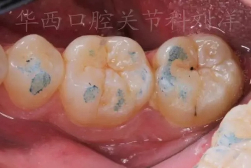 2.webp.jpg 2.webp.jpg