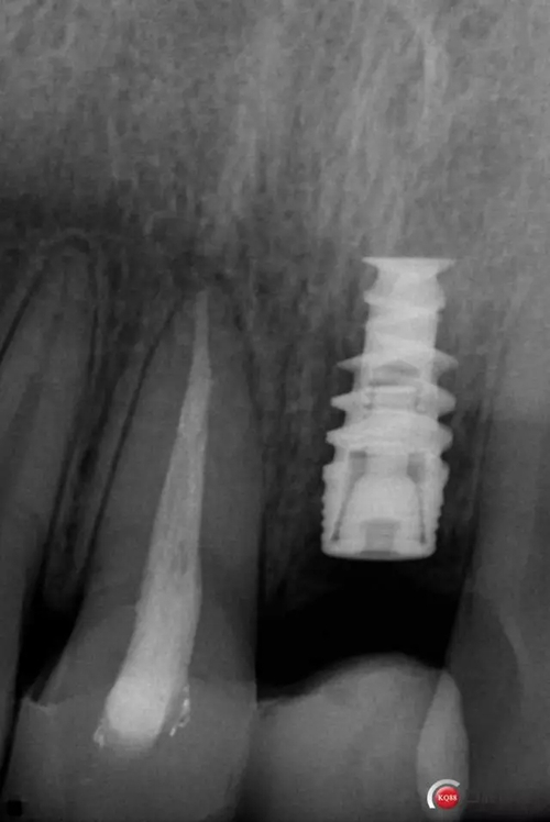 3.webp.jpg 3.webp.jpg