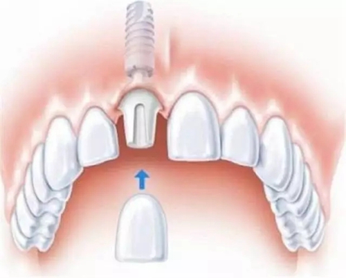 1.webp.jpg 1.webp.jpg