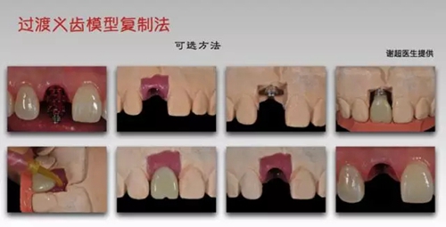 6.webp.jpg 6.webp.jpg