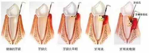 4.webp.jpg 4.webp.jpg