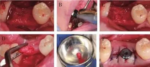 4.webp.jpg 4.webp.jpg