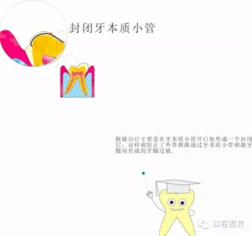  &ldquo;什么是牙周袋沖洗？&rdquo;