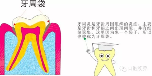 【愛牙科普知識300問】 &ldquo;什么是牙本質(zhì)敏感？&rdquo;