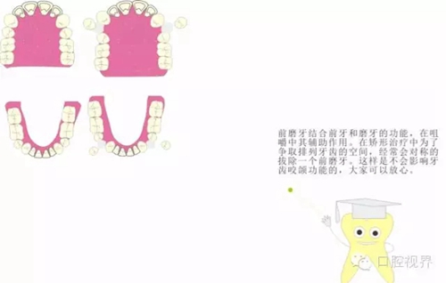 4.webp.jpg 4.webp.jpg