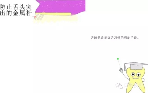 【愛(ài)牙科普知識(shí)300問(wèn)】 &ldquo;什么是牙間牽引？&rdquo;