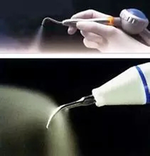 【愛牙科普】口腔謠言終結(jié)者&mdash;&mdash;每天刷牙，洗牙該不該？！