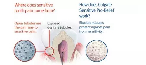 【愛牙科普】口腔謠言終結(jié)者&mdash;&mdash;每天刷牙，洗牙該不該？！