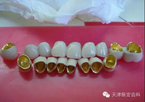 4.webp.jpg 4.webp.jpg