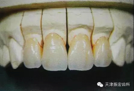 640.webp.jpg 640.webp.jpg