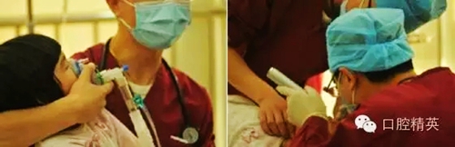 全麻下兒科治療+兒牙樹(shù)脂充填 全麻下兒科治療+兒牙樹(shù)脂充填