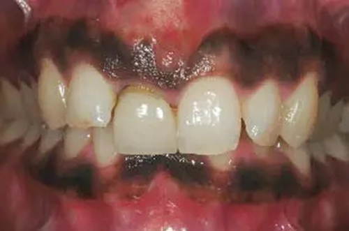 2.webp.jpg 2.webp.jpg