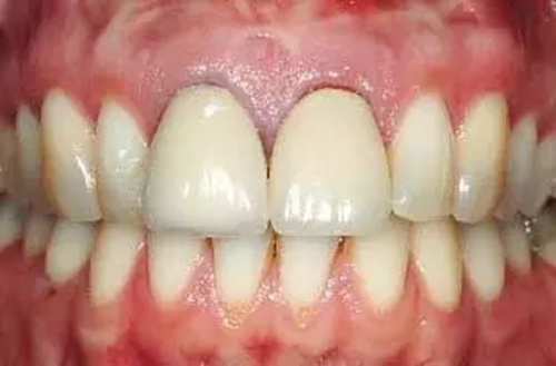 14.webp.jpg 14.webp.jpg