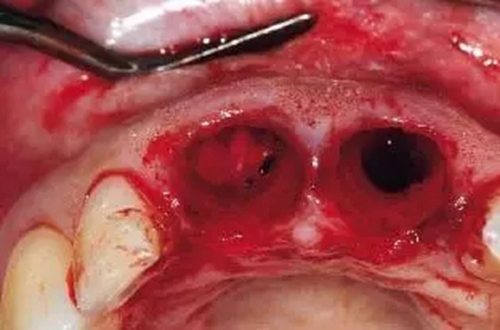 17.webp.jpg 17.webp.jpg