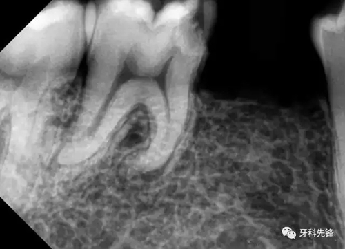 1.webp.jpg 1.webp.jpg