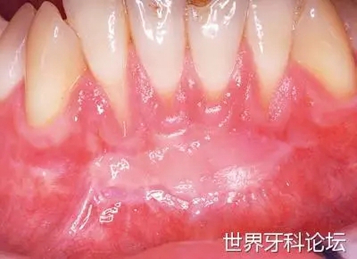 11.webp.jpg 11.webp.jpg